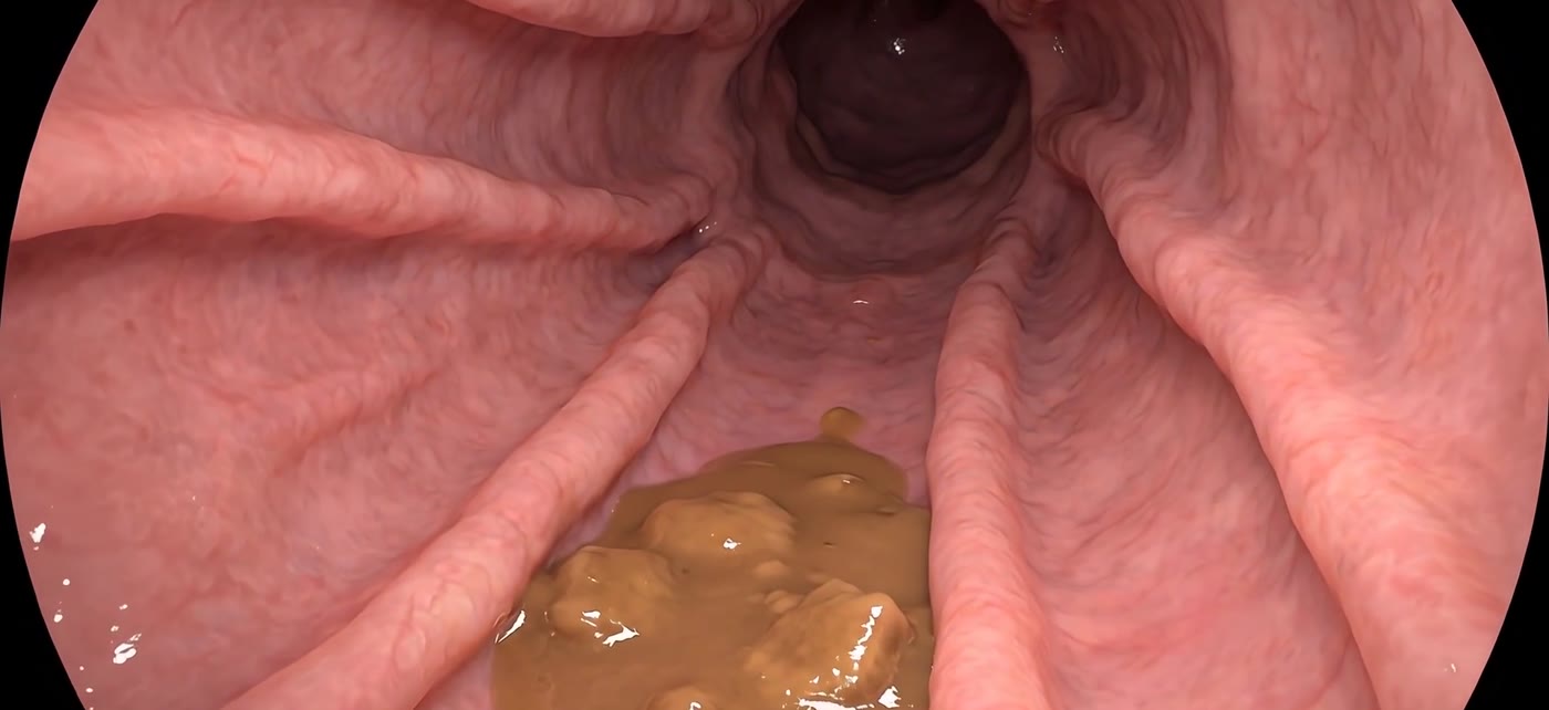 Endoscopic view
