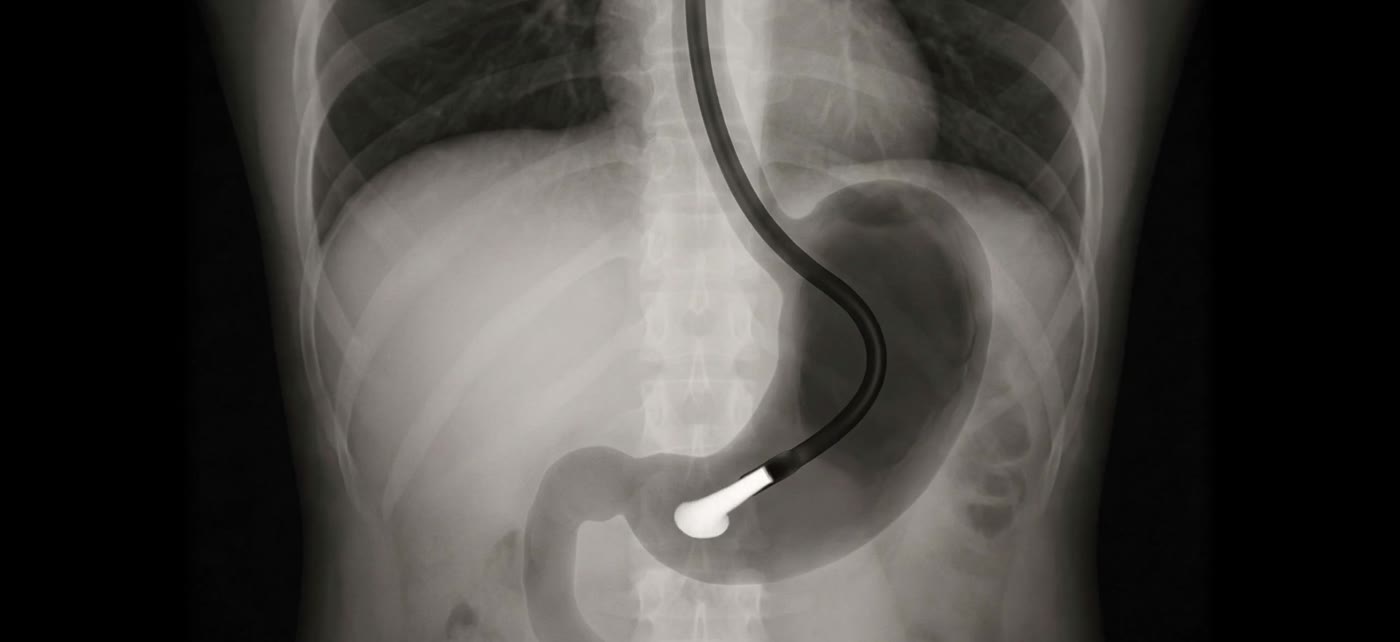 Fluoroscopic view